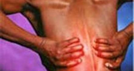 طبيب يحذر: الإنحناء الجانبي للعمود الفقري يظهر في المراهقة ويهدد القلب طبيب يحذر: الإنحناء الجانبي للعمود الفقري يظهر في المراهقة ويهدد القلب
