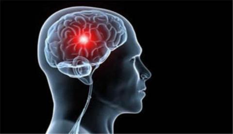 تزايد حالات الإصابة بالجلطات الدماغية لمن هم في سن العمل تزايد حالات الإصابة بالجلطات الدماغية لمن هم في سن العمل